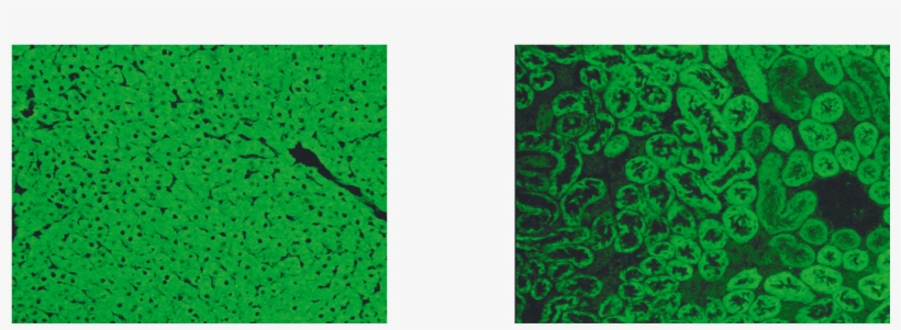 Indirect Immunofluorescence Showing Lkm-1 Autoantibodies, transparent png #7203105