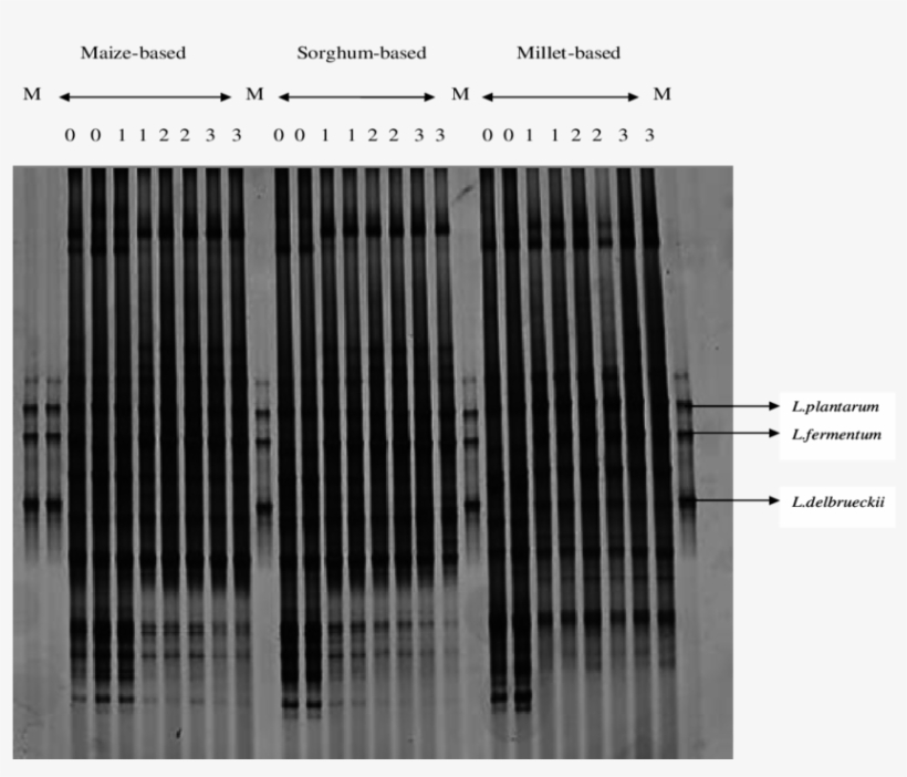 Dgge Analysis Of Pcr-amplified 16s Rdna Fragment For, transparent png #7218890