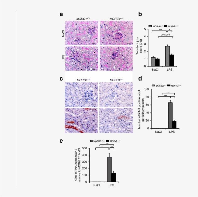 Analysis Of Renal Damage, transparent png #7341778