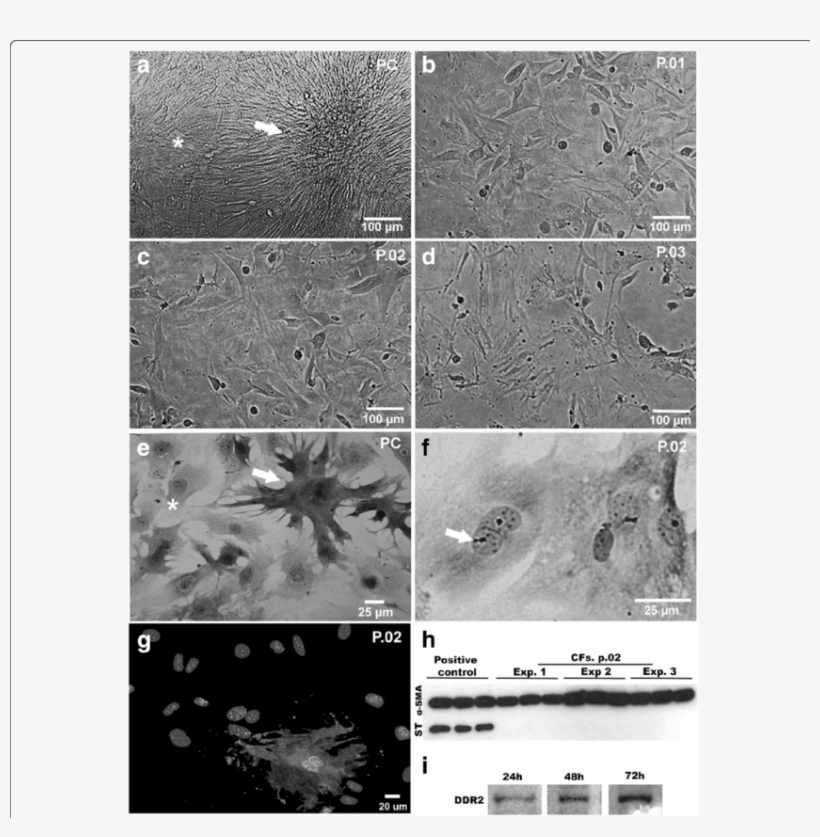 A-f Phase Contrast And Bright Field Microscopy Showing, transparent png #7367539