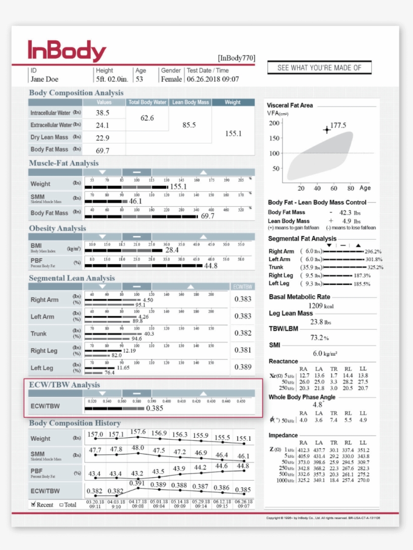 Ecw/tbw Analysis, transparent png #7378116