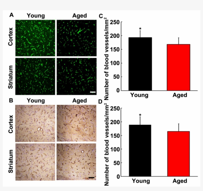 The Number Of Blood Vessels In Young Adult And Aged, transparent png #7381635