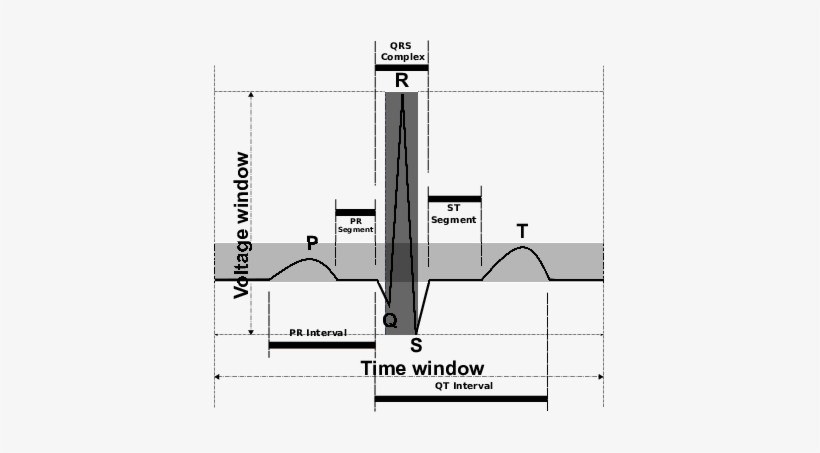 Typical Surface Ecg Signal Heart Beat - Heart Rate, transparent png #746121