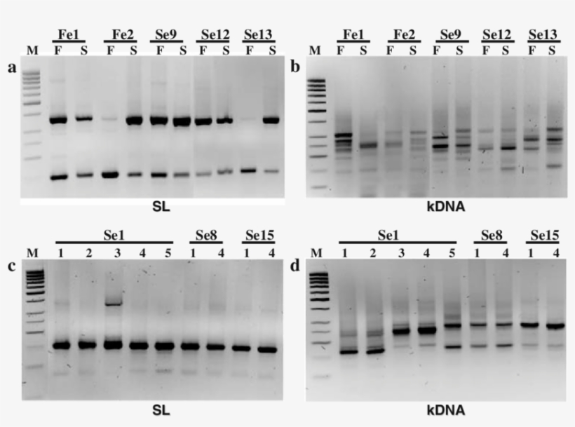 Three Percent Agarose Gel Electrophoretic Analysis, transparent png #7408356