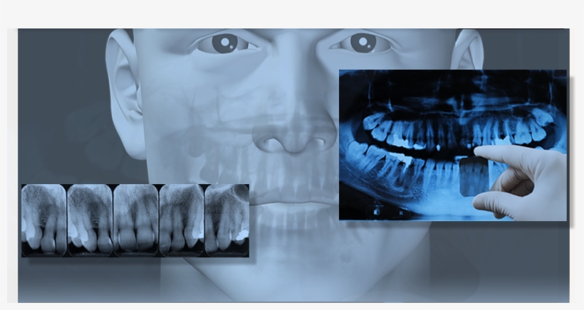 Dental X-ray, transparent png #7439036
