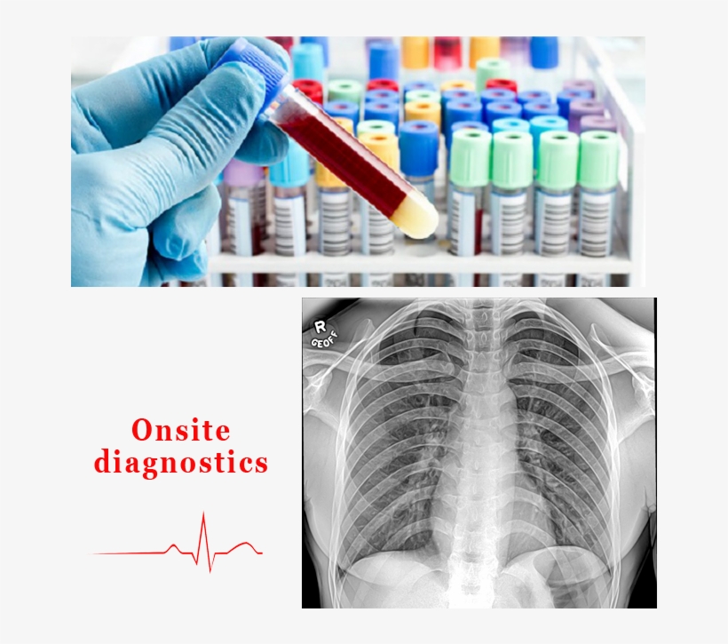 Onsite Services, transparent png #7439602