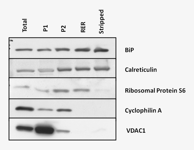 Following The Purification Of Rat Pancreatic Rer By, transparent png #7439770