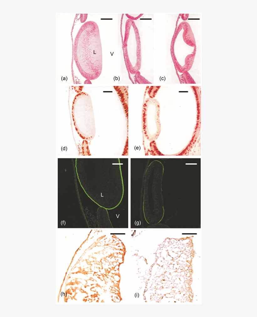 Micrographs Of Middle Sections Of Chick Lens Anlagen, transparent png #7443637