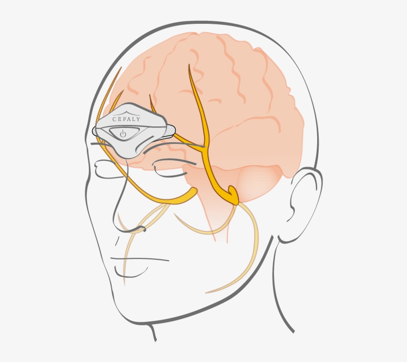 Treatment And Prevention Of Miraine, transparent png #7467736