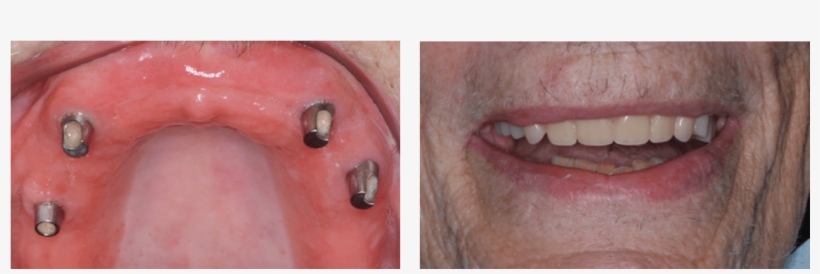 509 York Rd Jenkintown Pa 19046 215 635, transparent png #7470006