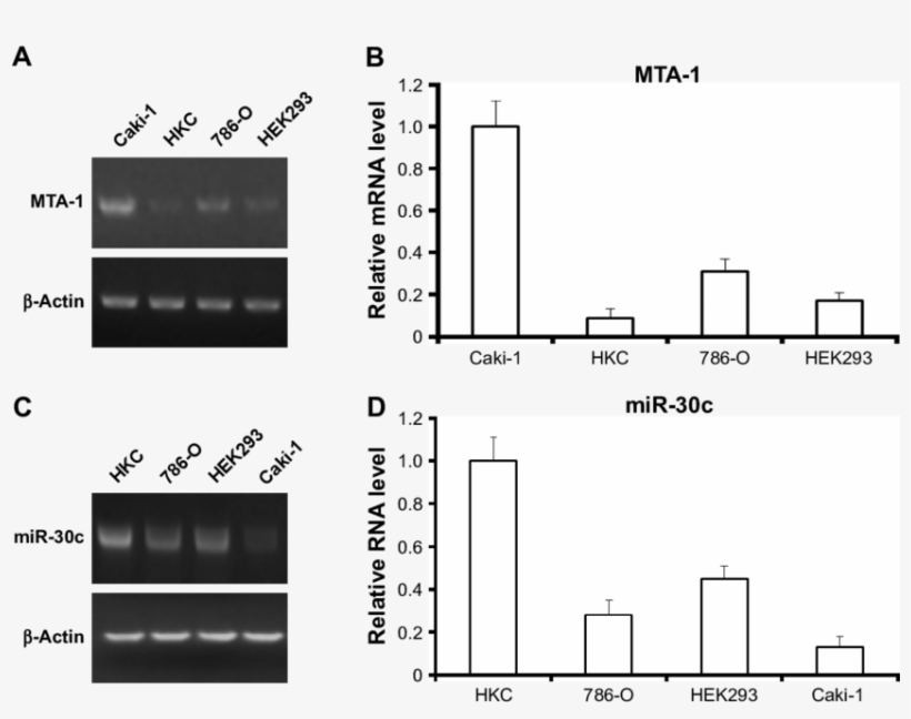 Expression Of Mir 30c Is Inversely Associated With, transparent png #7496640