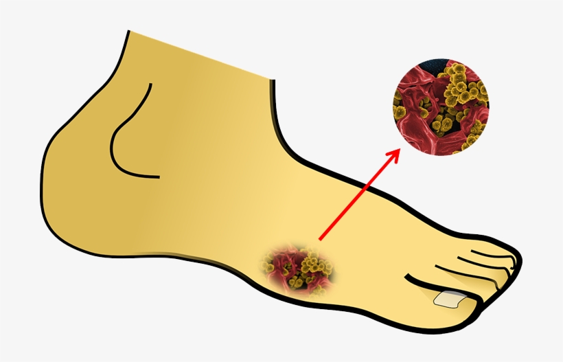 Treatment, transparent png #7558050