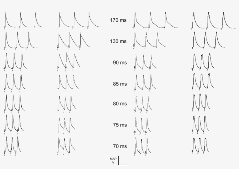 Epicardial Monophasic Action Potential Recordings Obtained, transparent png #7576249