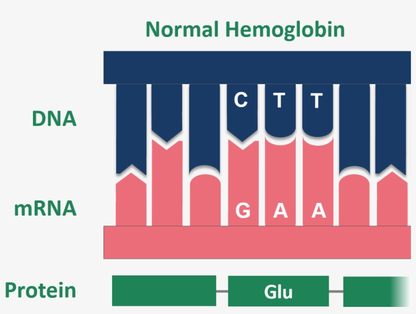 Point Mutation Sickle Cell Normal Hemoglobin, transparent png #7580519