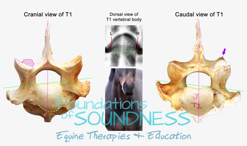 But The Most Interesting Revelation About The Dvl's - Medical Imaging, transparent png #7615501