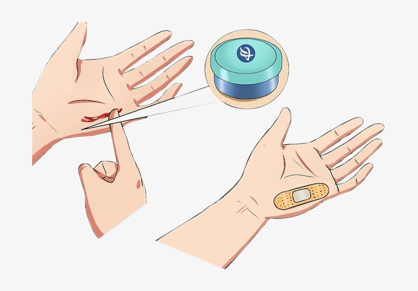 Treatment - - جرح اليد بالسكين كرتون, transparent png #7624869