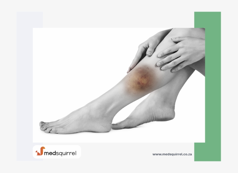 First Aid - Toe, transparent png #7625297