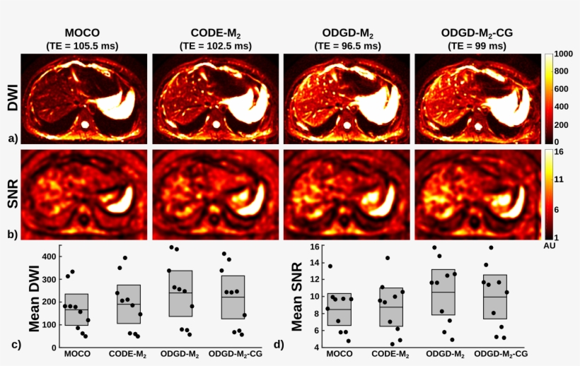 Optimized Diffusion-weighting Gradient Waveform Design - Graphic Design, transparent png #7629040