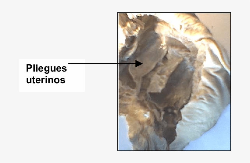 Cápsulas Uterinas Y Membrana Del Huevo O Tercer Membrana - Shell, transparent png #7633152