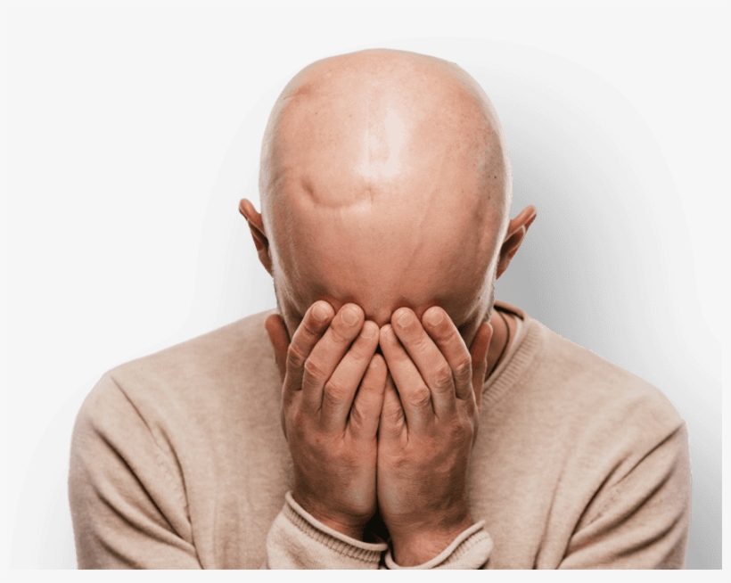 Man With Scarring On Head Holding Hands To Face - Cancer, transparent png #7702719