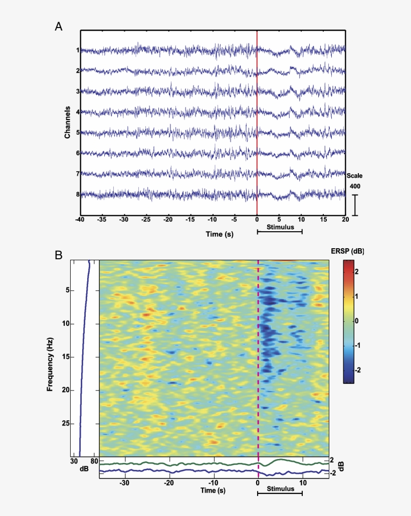 Desynchronization Of Eeg In Pigeons Caused By Stimulation - Plot, transparent png #7741170