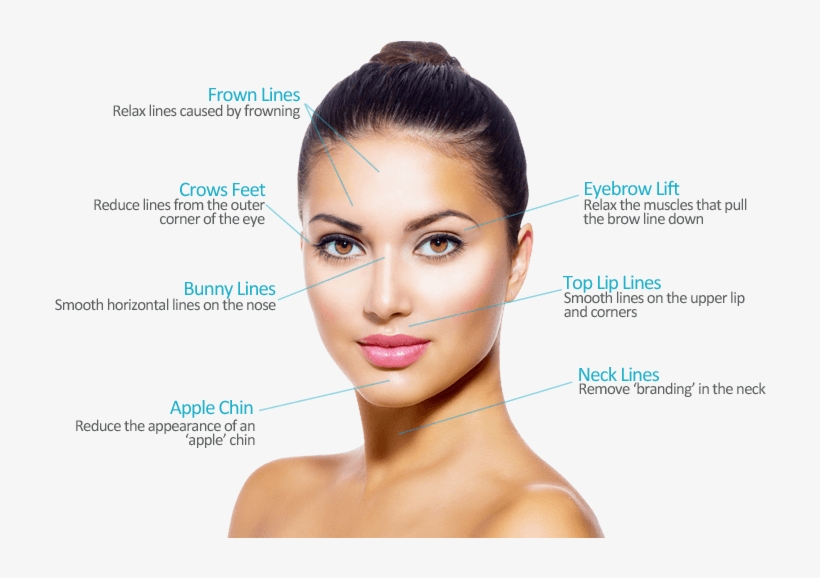 Botox Areas - Facial Aesthetics, transparent png #7765754