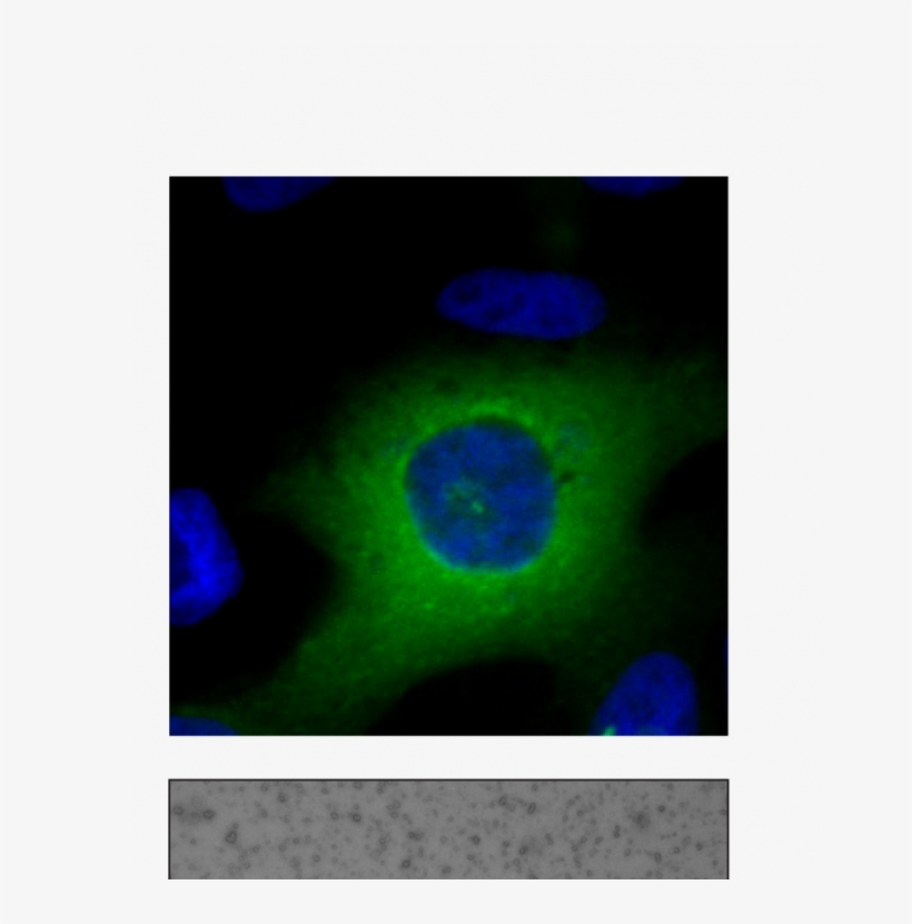 "gotas Líquidas " De Cpeb4en El Citoplasma Celular - Circle, transparent png #7797180