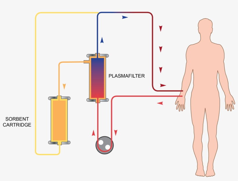 Ppt Slide 24 Selective Aferesi - Diagram, transparent png #7807291