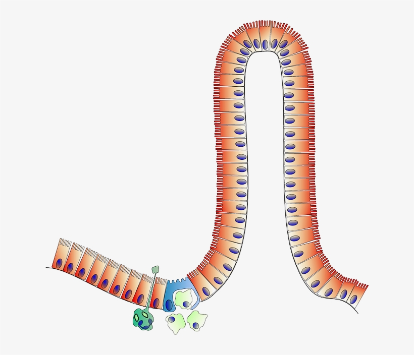 Celiac Disease - Enterocyte Cartoon, transparent png #7838076