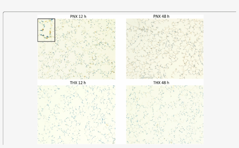 Representative Findings Of Immunohistochemistry For - Number, transparent png #7857179