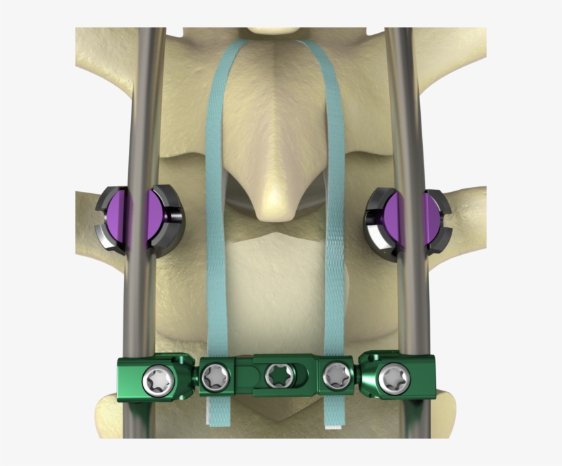 Nile Prox St Img 02-e1499344743694 - Sub Laminar Band, transparent png #7861994