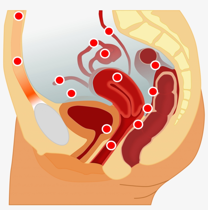 La Endometriosis Es Una Enfermedad, No Un Dolor De - Possible Locations Of Endometriosis, transparent png #7871279