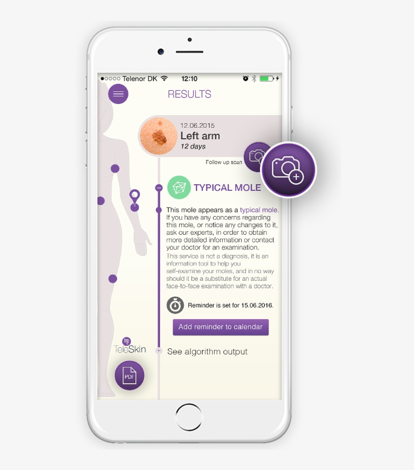 Go To Your Mole Diary, Click On The Image That You - Iphone, transparent png #7877061