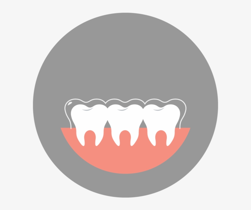 Invisalign-art - Illustration, transparent png #7906605