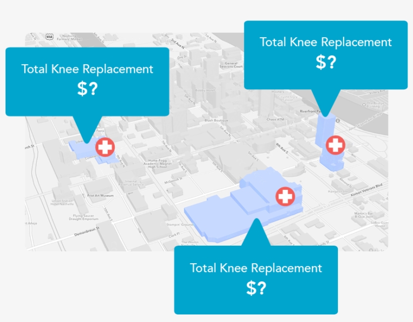 Image Showing Differing Procedure Prices In An Area - Diagram, transparent png #7914259