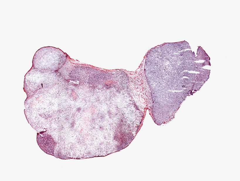 Visualization Of Th-302, A Cancer Therapeutic - Illustration, transparent png #7914994