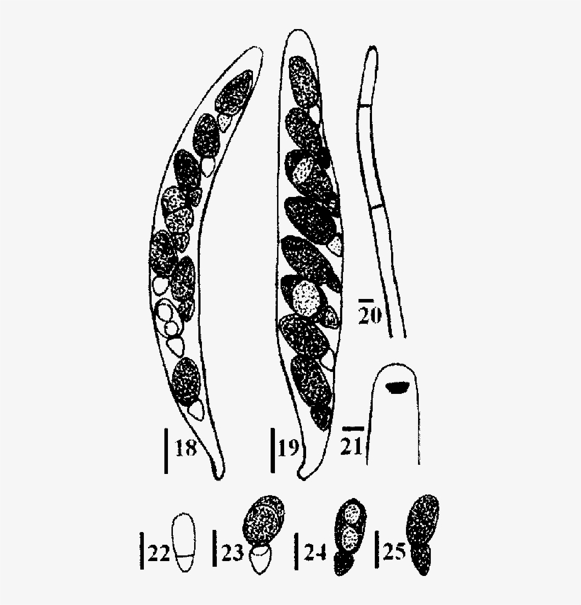 Ascus Apex With A J Subapical Ring - Illustration, transparent png #7991954
