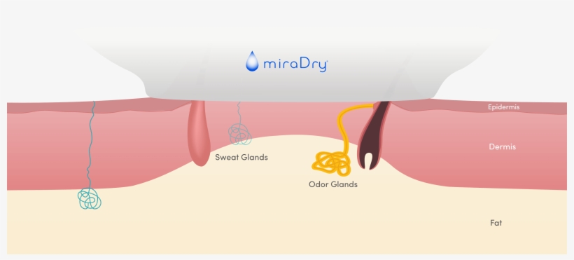 Next, The Handpiece Is Activated - Diagram, transparent png #8041373