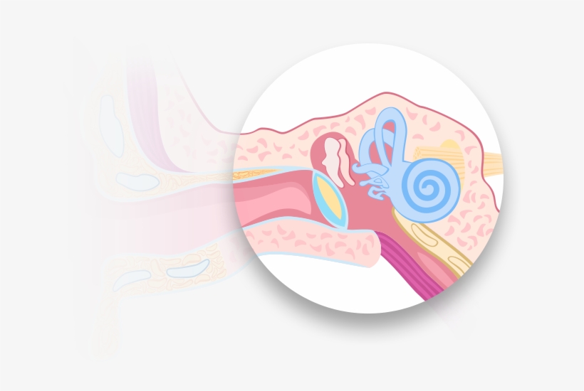 Conductive Hearing Loss - Text, transparent png #814332
