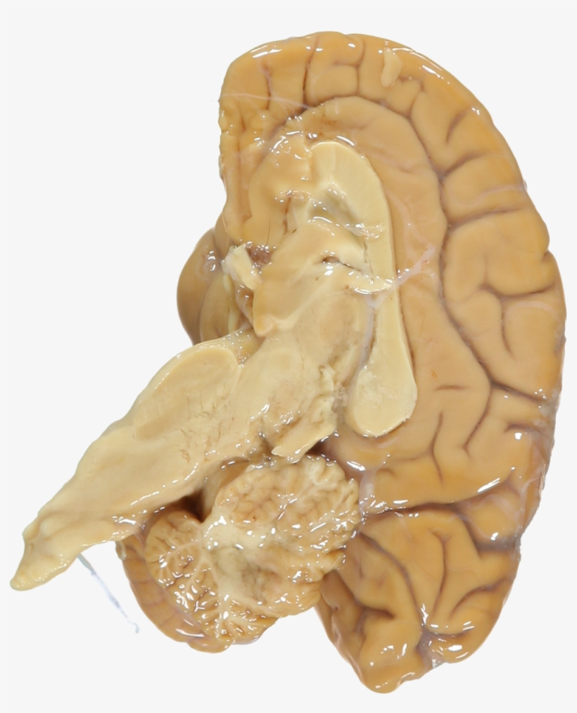 2009-01~processed - Western Gorilla Brain, transparent png #8167324