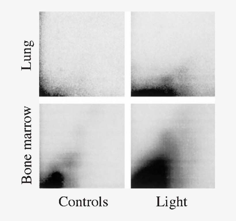 Examples Of Autoradiographic Patterns Of Dna Adducts - Monochrome, transparent png #8197684