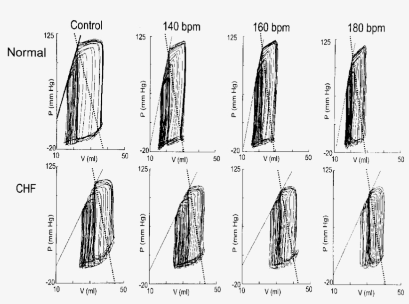 Variably Loaded Pressure Volume Loops At Increasing - Sketch, transparent png #8198078