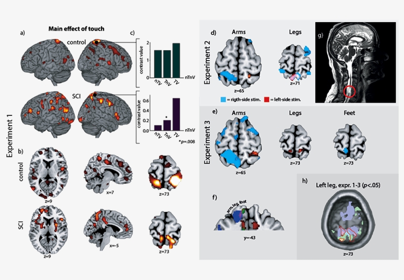 Both The Healthy Control And The Spinal Cord Injury - Illustration, transparent png #8247522
