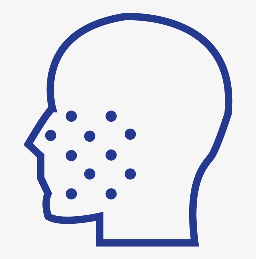 Vitamin Injection For Acne - Ad Villaviciosa De Odon, transparent png #8268311