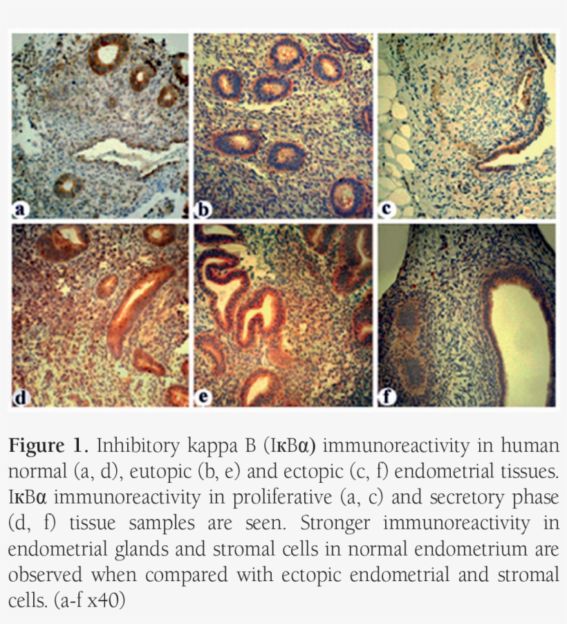 Inhibitory Kappa B Immunoreactivity In Human Normal - Visual Arts, transparent png #8269861