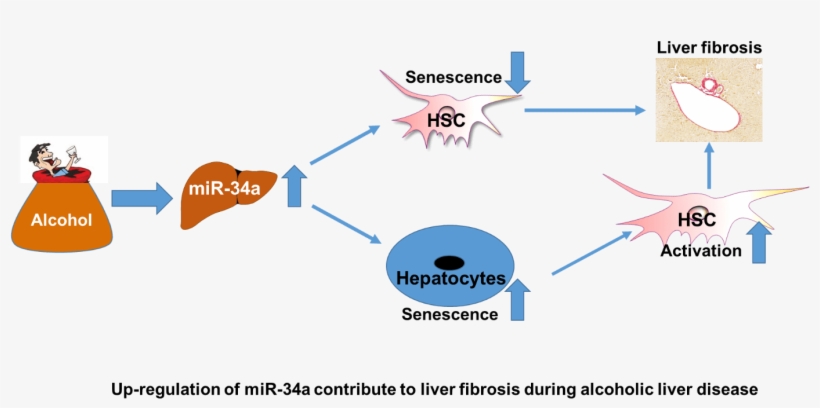 “understanding The Mechanisms Underlying Hsc Activation - Senescence Liver, transparent png #8309231