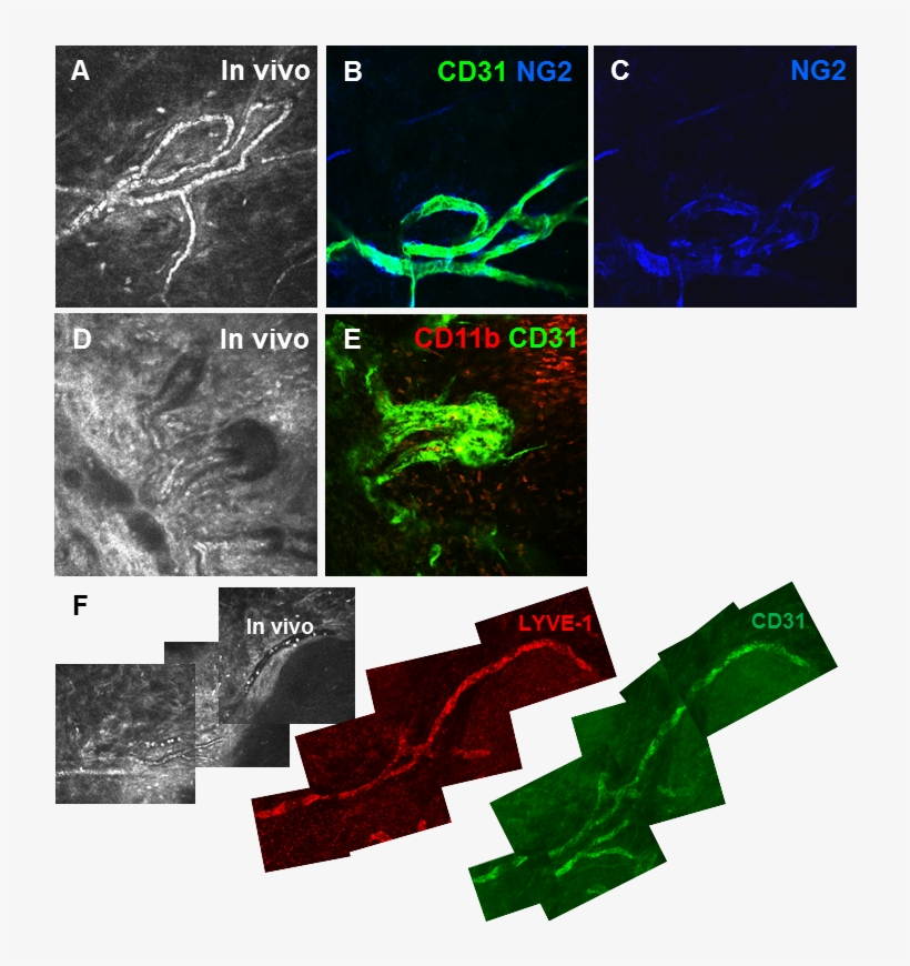 Figure 21 - - Cd31 Cornea, transparent png #8318186