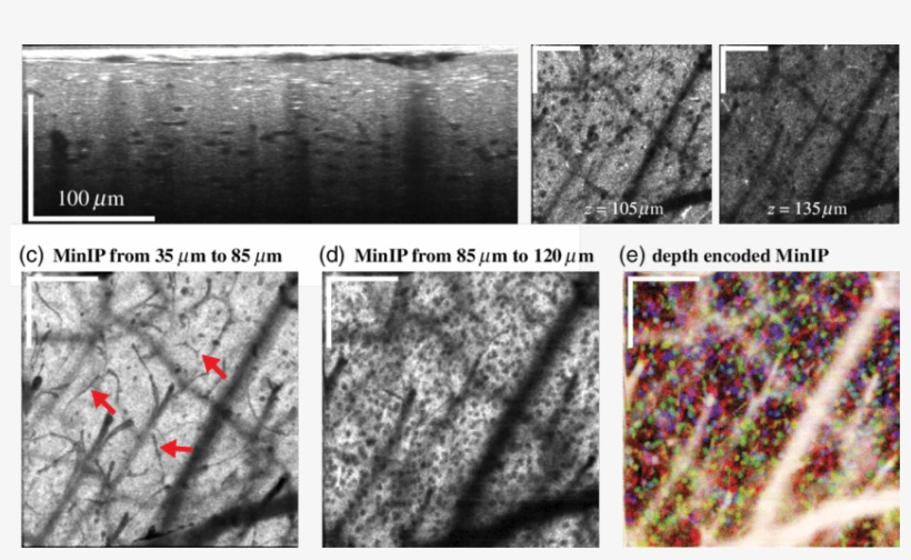 Xf Visocm In Vivo Imaging Of Neural Cells - Tree, transparent png #8318217