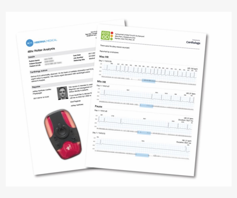 Holter Ecg Heart Monitor - Bugatti Veyron, transparent png #8351403