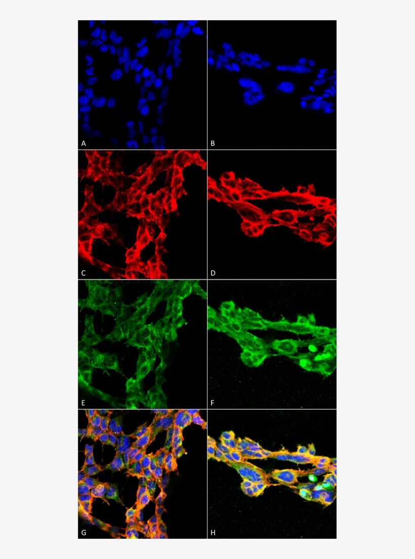 Smc 512 7 Ketocholesterol Antibody 7e1 Icc If Human - Art, transparent png #8375397